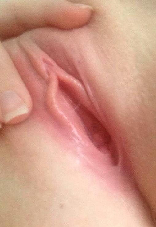 My vagina