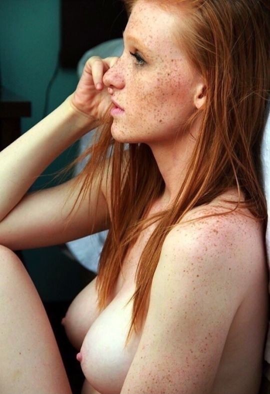 Frecklelicious