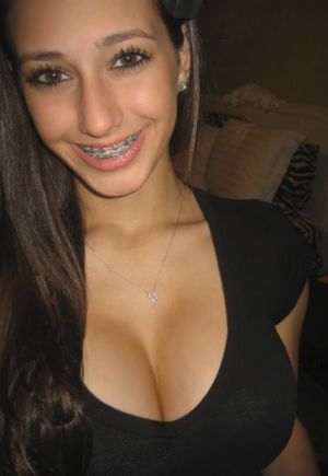 Braces Porn Gifs and Pics MyTeenWebcam 